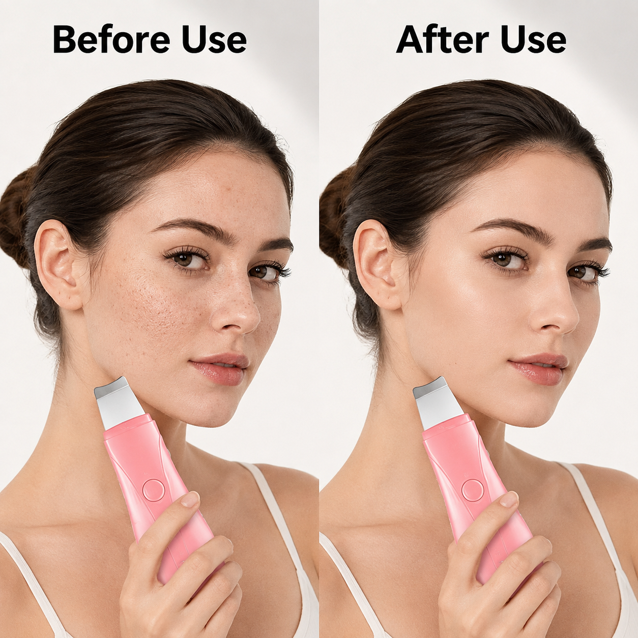 Blackhead Removal, Deep Cleansing, Skin Exfoliation, And Home Skincare