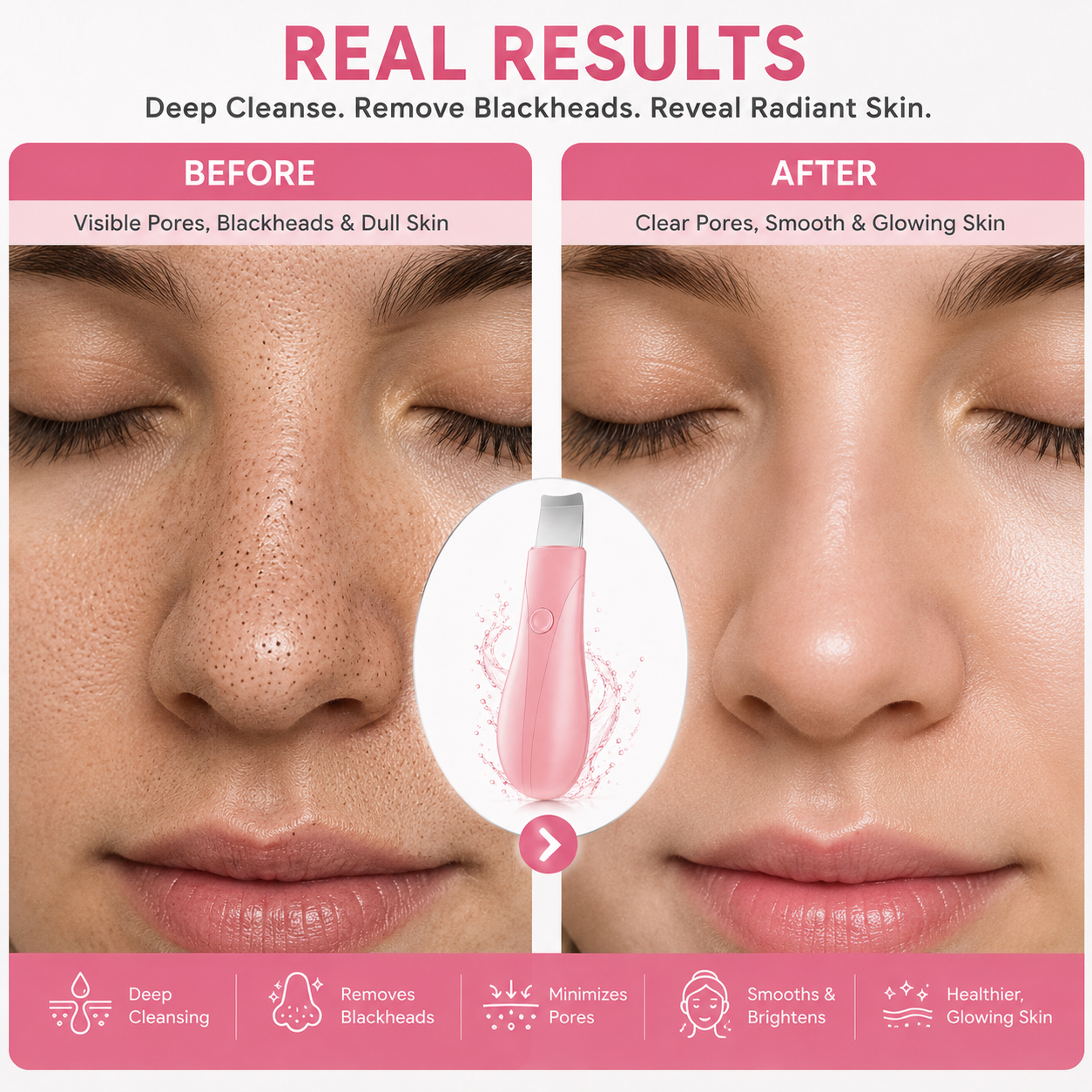 Blackhead Removal, Deep Cleansing, Skin Exfoliation, And Home Skincare